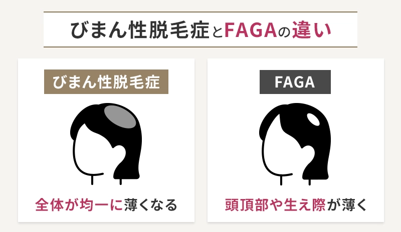 びまん性脱毛症とFAGAの違い