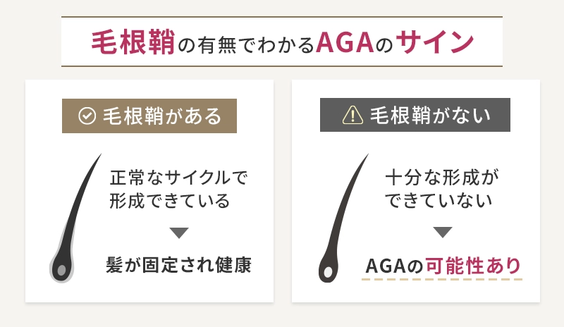 毛根鞘の有無で分かるAGAのサイン