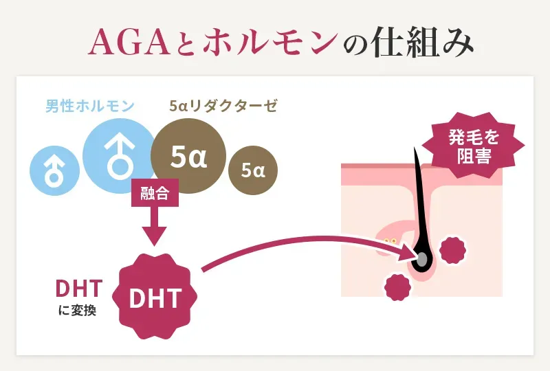 AGAとホルモンの仕組み