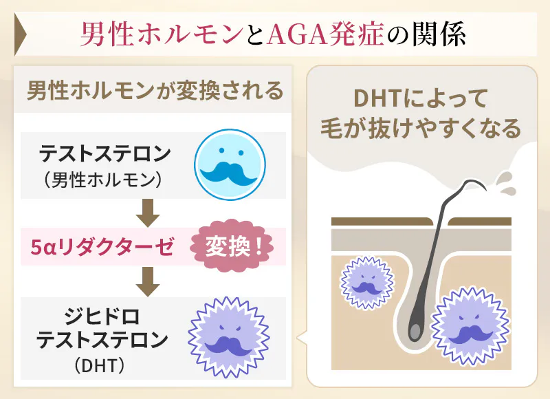 男性ホルモンとAGA発症の関係性