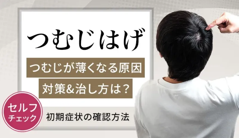 つむじはげの原因と治し方は?AGAとの見分け方から効果的な対策も解説