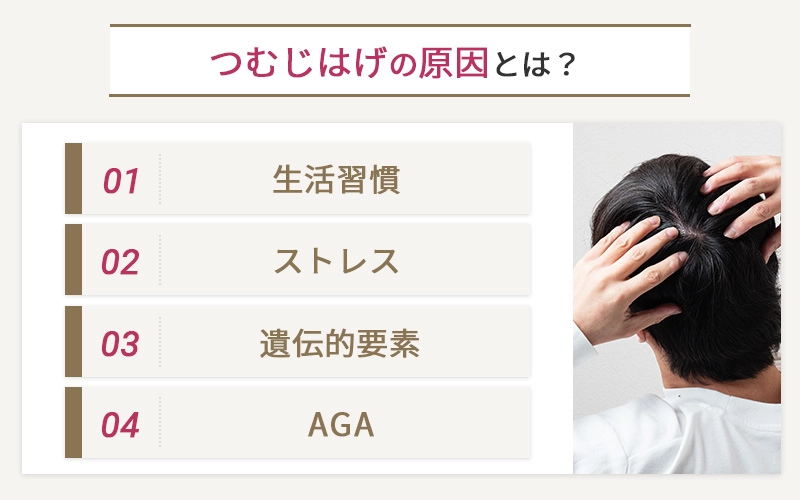 つむじはげの原因とは?
