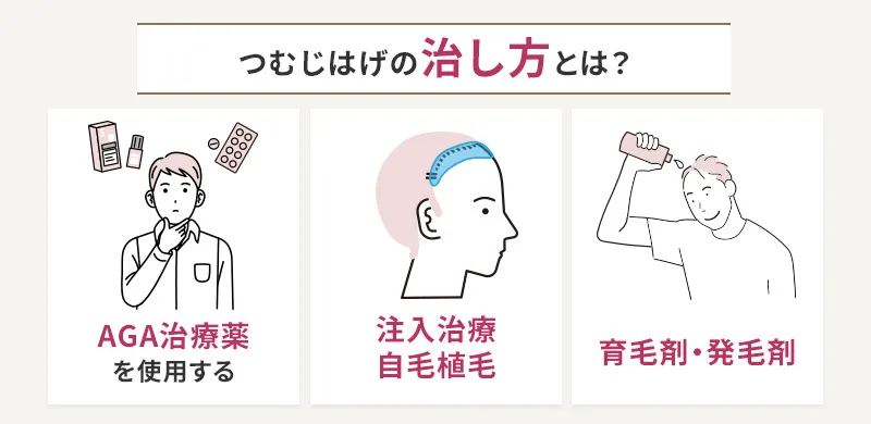 つむじはげを治す3つの方法