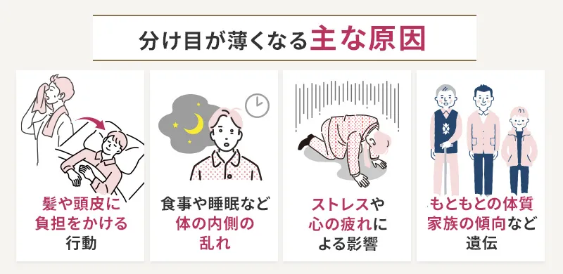 分け目ハゲと抜け毛の量の関係性