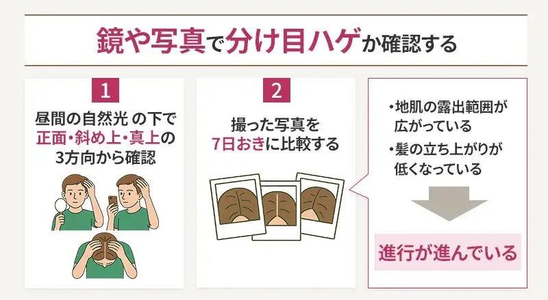 自分でできる分け目ハゲの確認方法