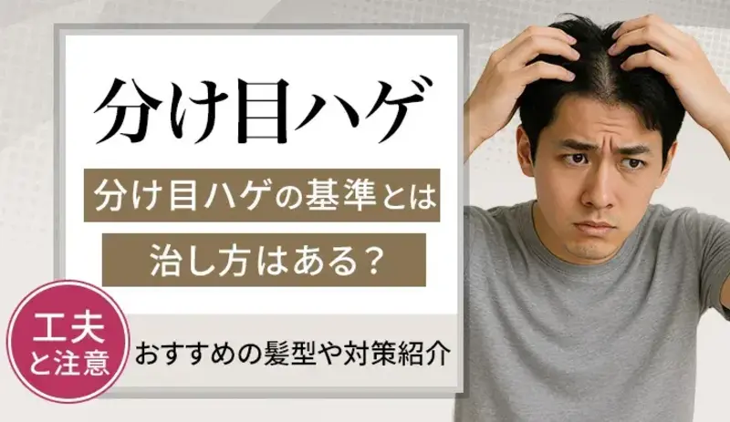 分け目ハゲの原因と治し方とは！セルフチェックの基準や隠す髪型も解説
