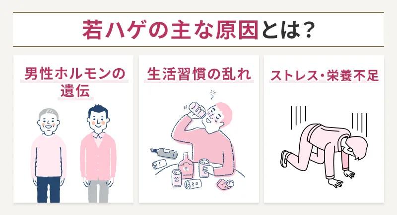 若ハゲが発症する3つの主な原因