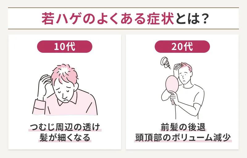 若ハゲの年代別によくある症状